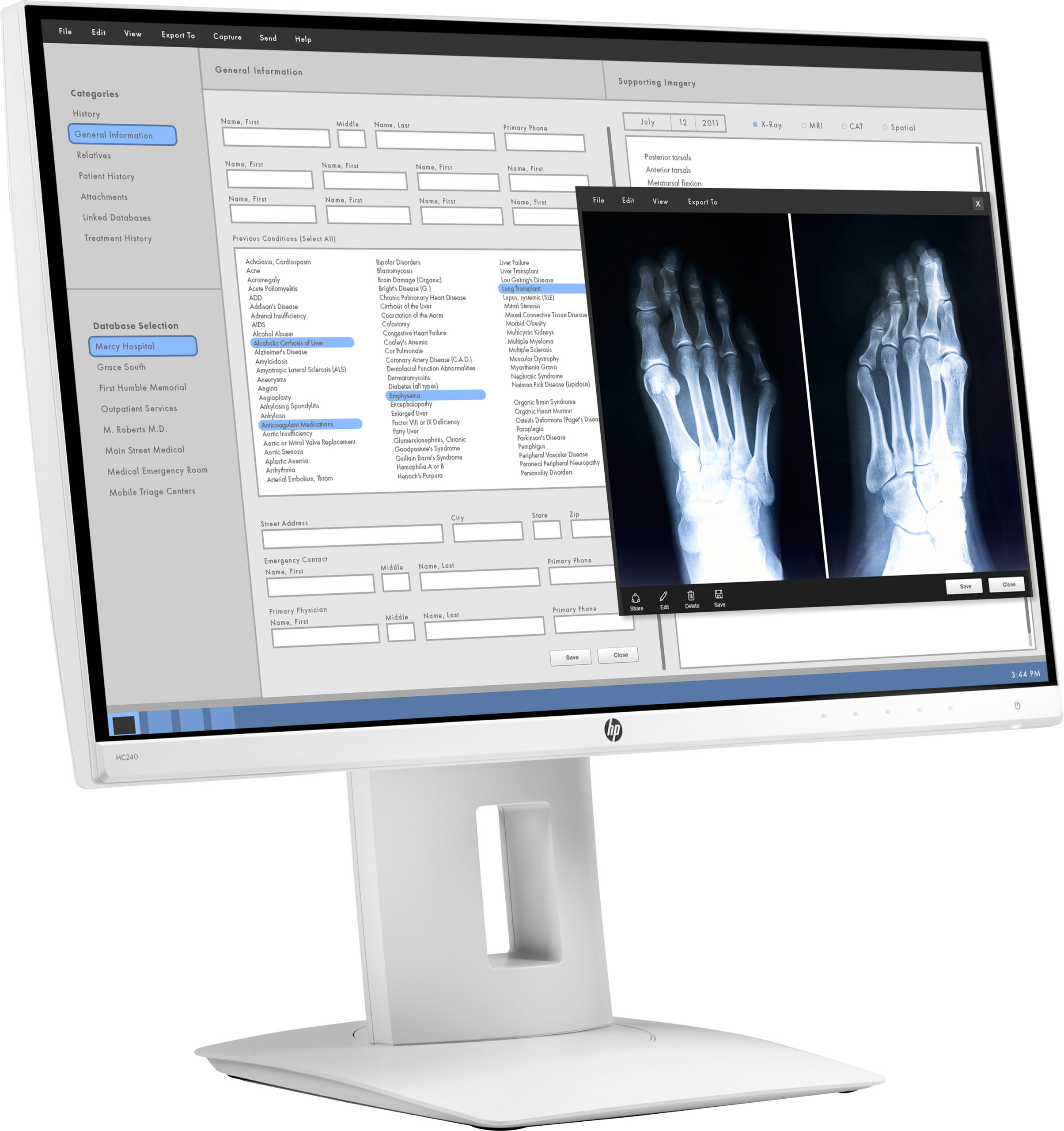 HP HC240 Healthcare Edition monitor komputerowy 61 cm (24") 1920 x 1200 px WUXGA LED Biały - obrazek 4