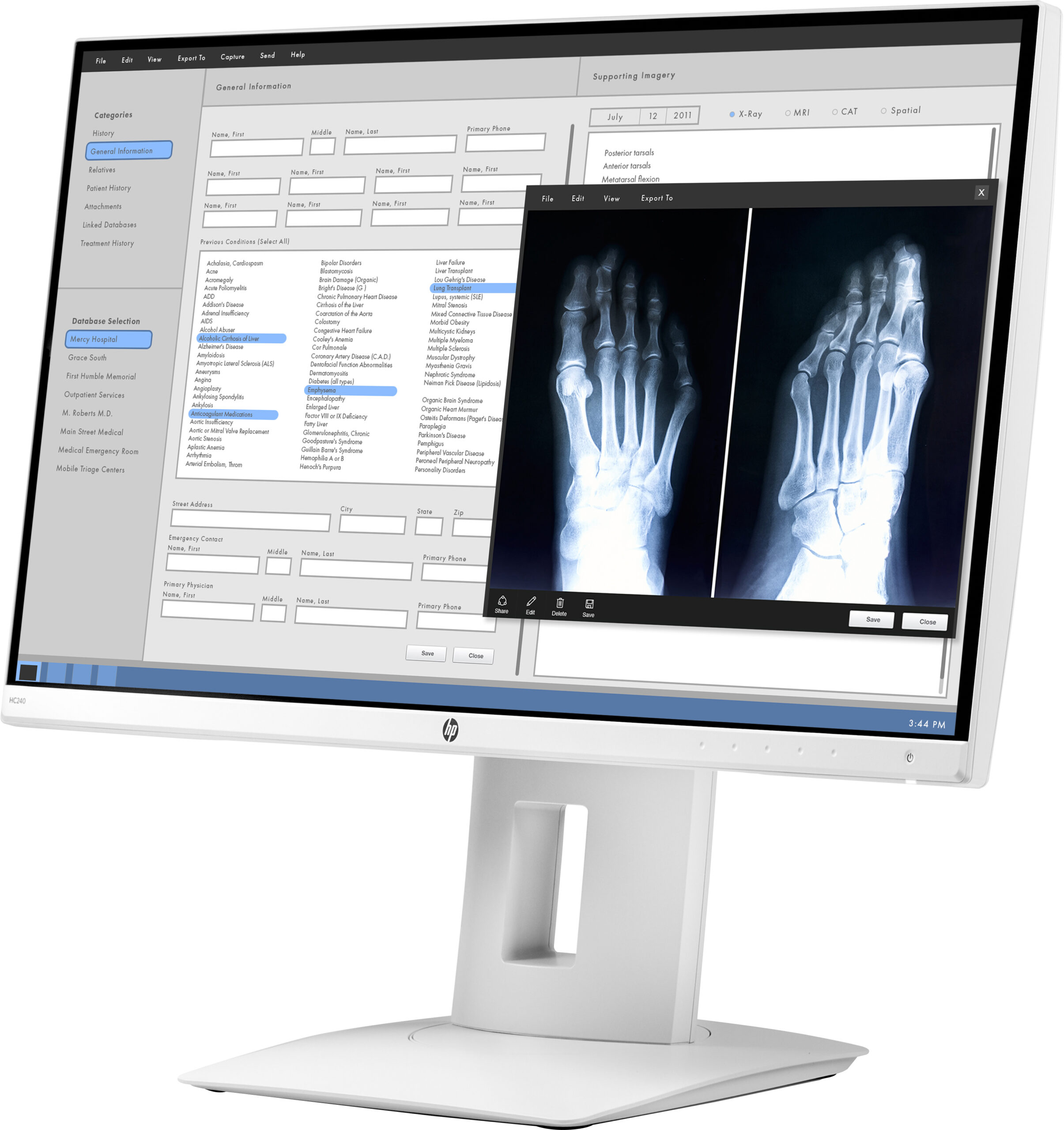 HP HC240 Healthcare Edition monitor komputerowy 61 cm (24") 1920 x 1200 px WUXGA LED Biały - obrazek 2